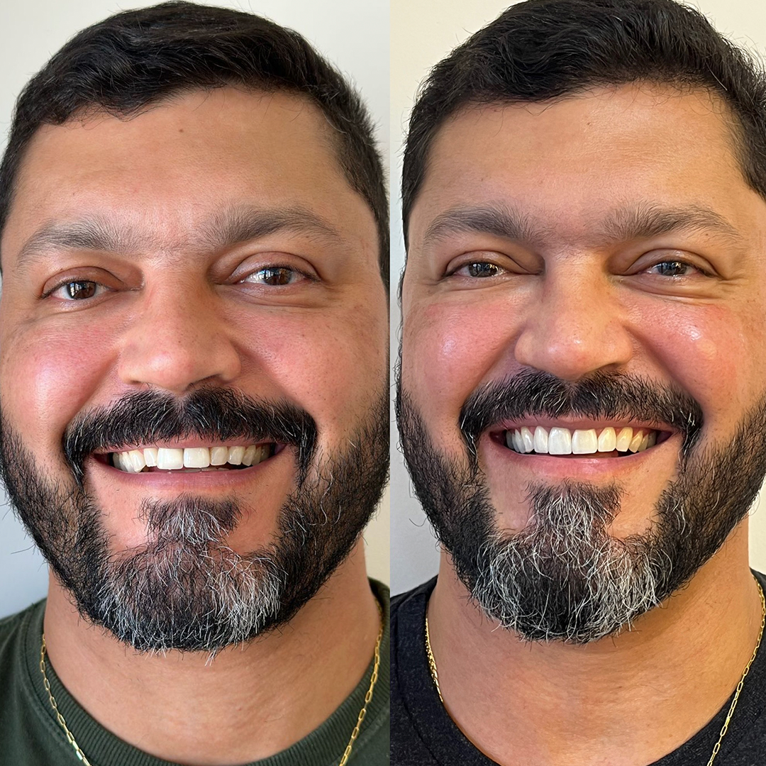 Antes e depois - Caso 3