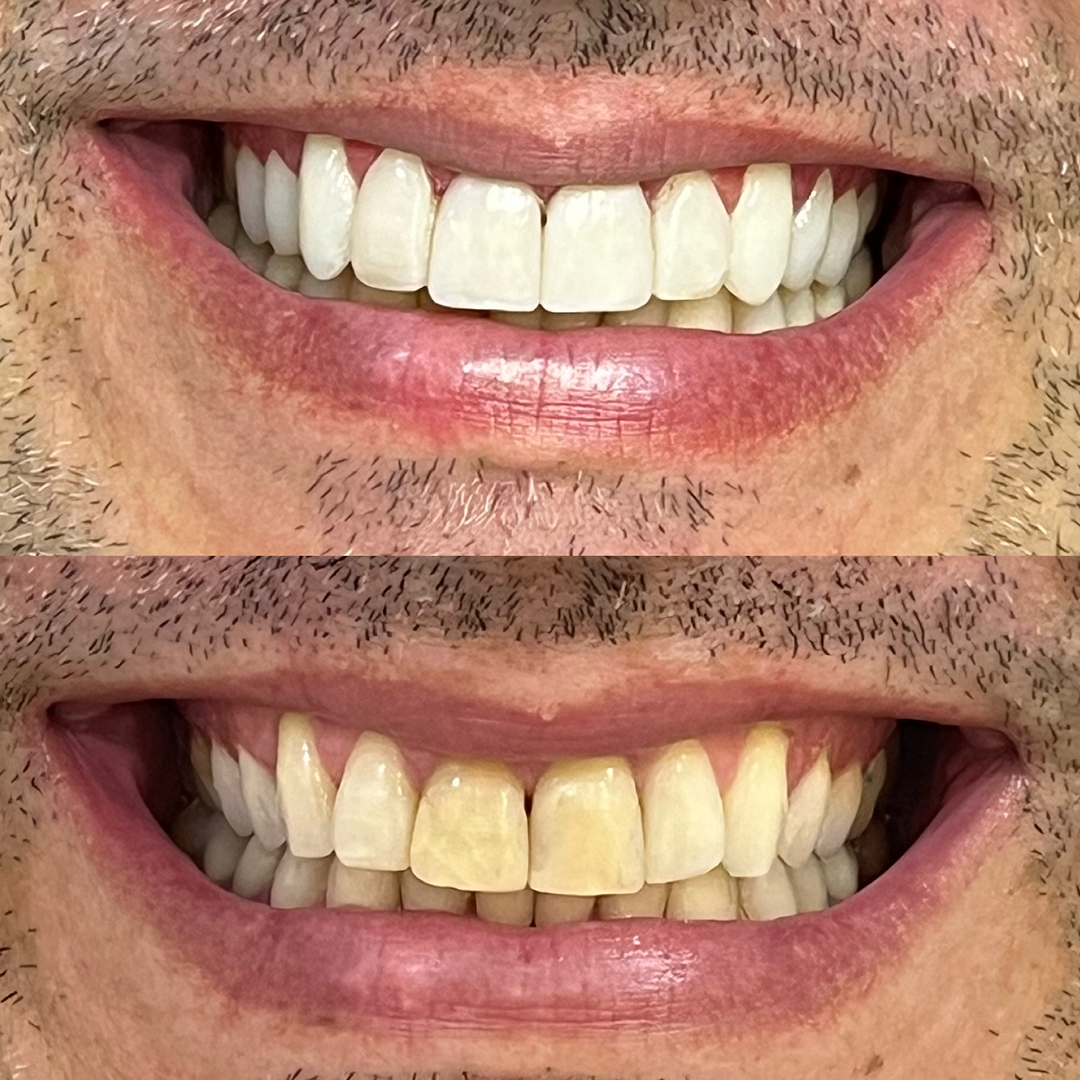 Antes e depois - Caso 2